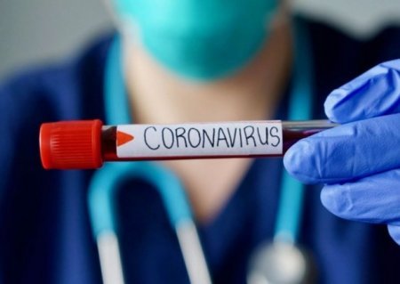 Azərbaycanda koronavirusa yoluxanların sayı artdı - 15 nəfər vəfat etdi Azərbaycanda koronavirusa yoluxanların sayı artdı - 15 nəfər vəfat etdi